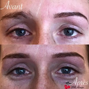 Épilation des sourcils complète : Avant-Après